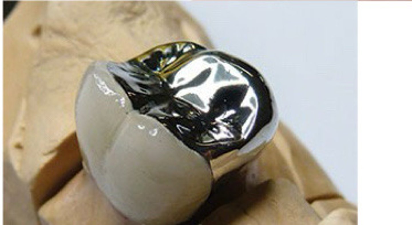 <p>PFM __ occlusal</p>