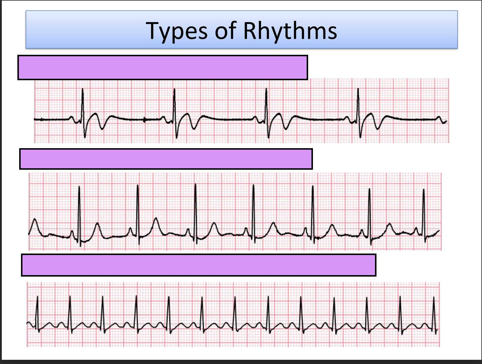 <p>name these types of rhythms</p>