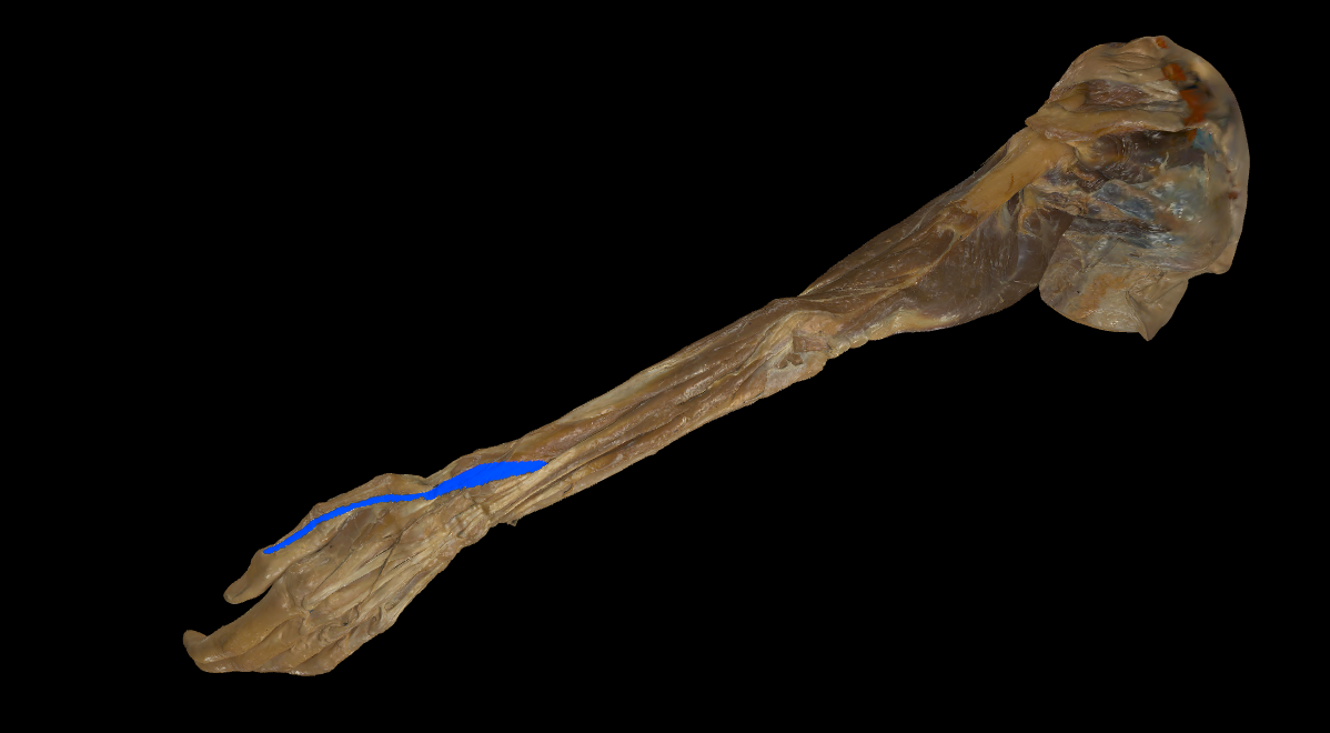 term image