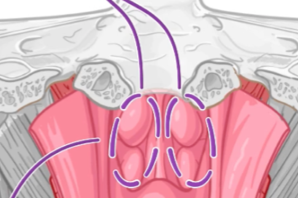 <p>Two openings found at the back of the nasal passage between the nasal cavity and the pharynx</p>