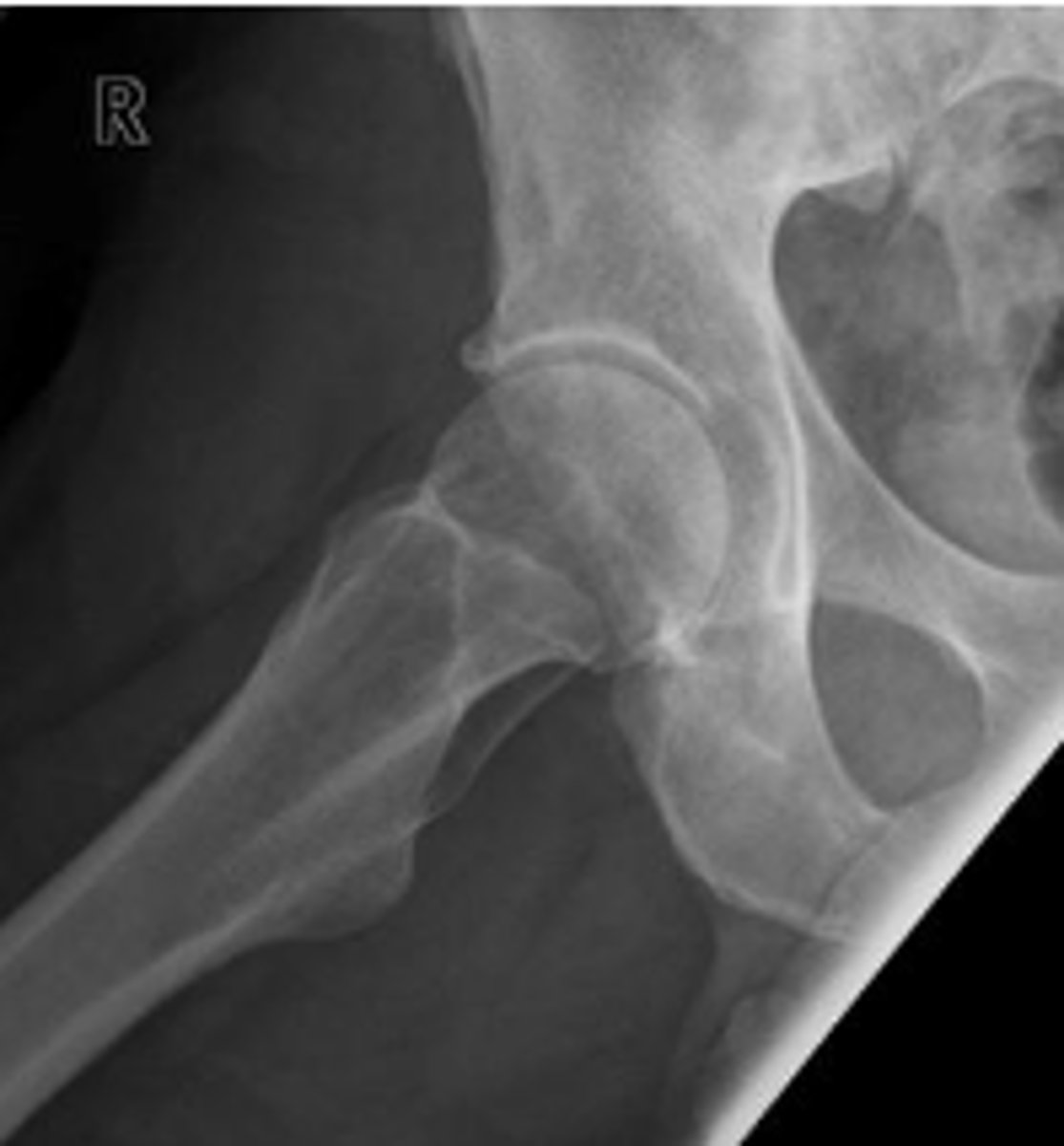 <p>What is the name of the radiographic view?</p>