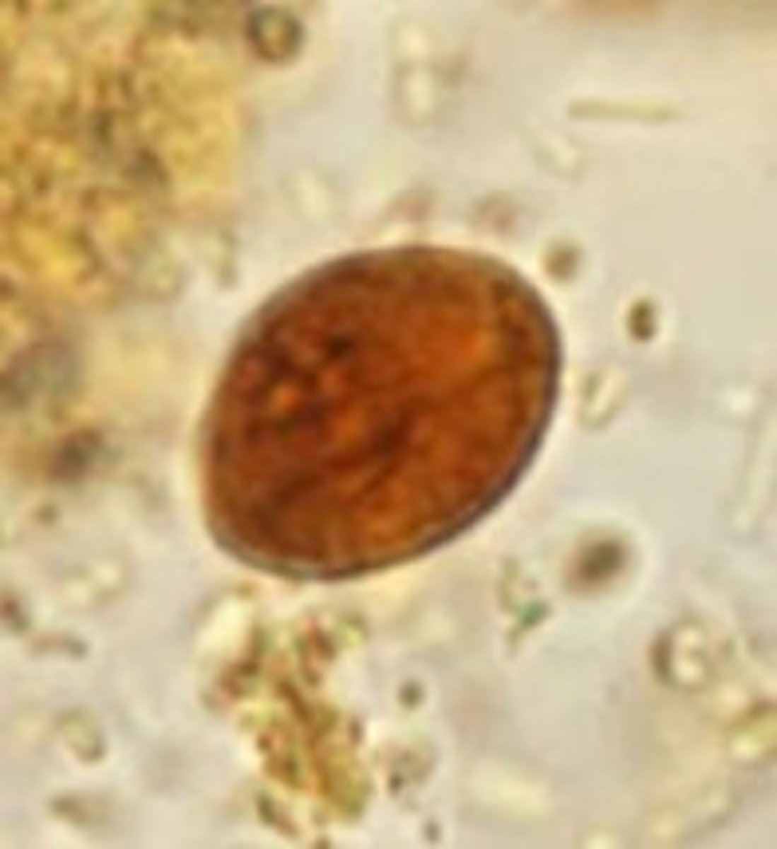 <p>Identify the parasite</p>
