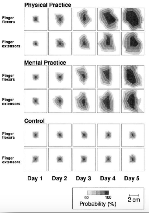 <p><u>functional modular plasticity=</u> what's happening at the network level, as opposed to the individual/cellular level or what’s happening at individual synapses</p><ul><li><p>a <strong><u>***representational area carrying out a specific function ***expands as a ***result of the ***performance of that function or ***repeated exposure to a stimulus</u></strong></p></li><li><p><strong><u>***engagement in an activity causes the brain to change</u></strong>; these <strong><u>***changes then influence adaptive behavioral responses</u></strong></p></li><li><p>e.g., there is <em>map expansion in humans acquiring a new motor skill</em></p></li></ul><p></p>