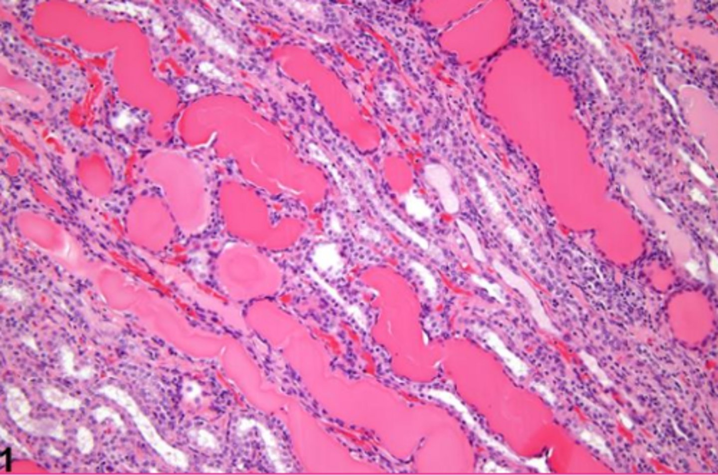 <p>What extracellular inclusion?</p>
