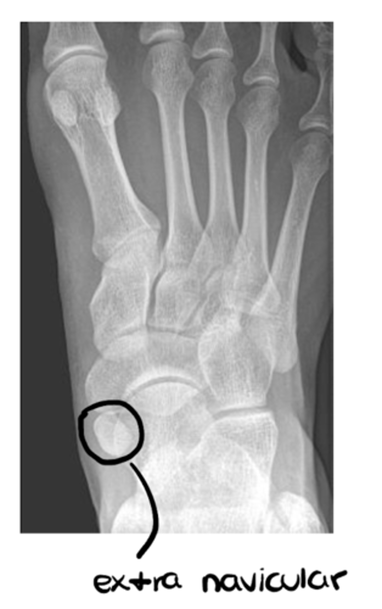 <p>- Aberrant size of bones</p><p>- Supernumerary bones (i.e., extra bones)</p><p>- Congenital abnormality</p><p>- Absence of any bones</p><p>- Developmental deformities</p>