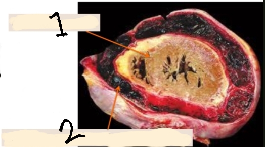 <p>identify ?</p><p>other types ?</p><p>Number 1,2 refer to what?</p>