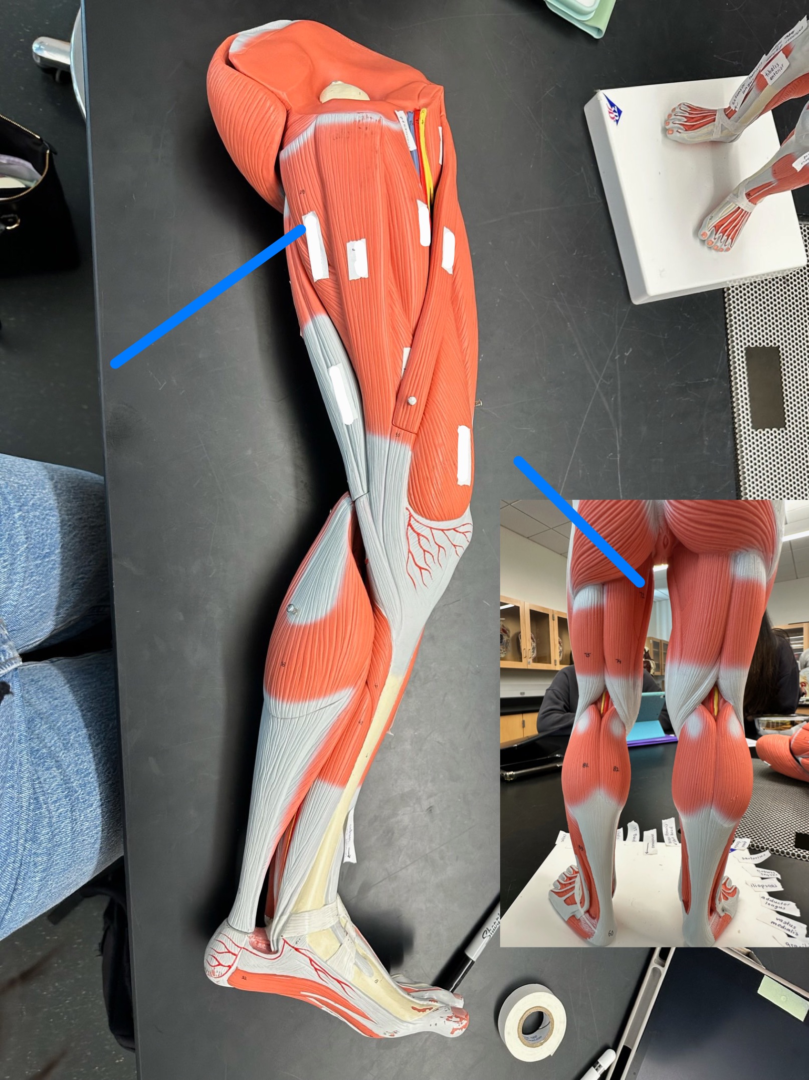 <p>ID muscle</p>