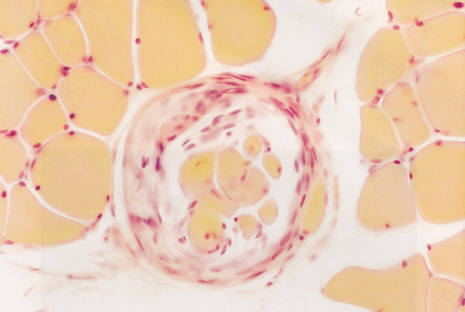 <p>B. Arrow 1 points to an intrafusal muscle fiber.</p>