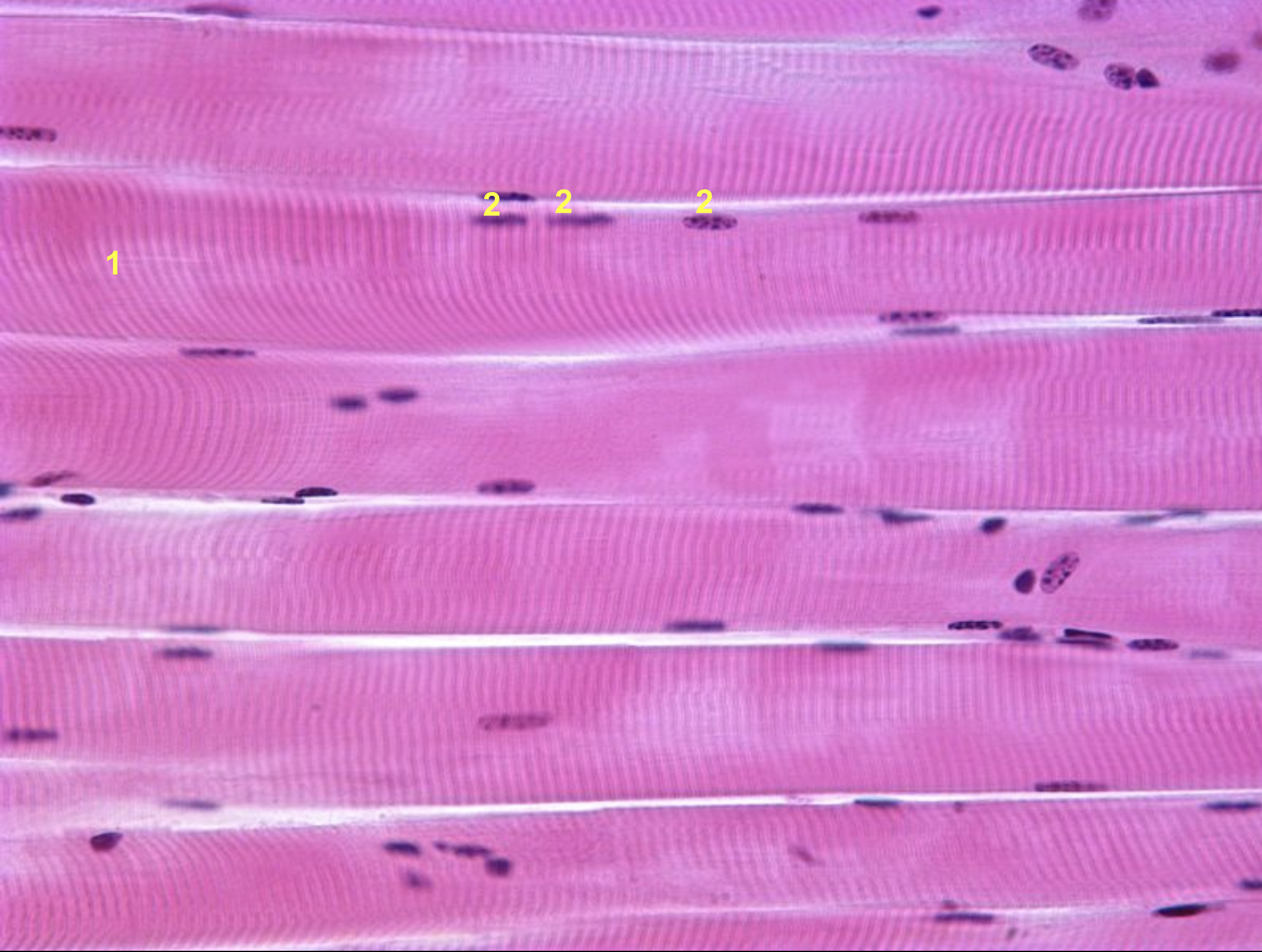 <p>Characteristics of skeletal muscle (location, function, control mode, shape)</p>