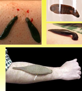 <p>Phylum Annelida, Class Clitellata, and Subclass Hirudinea</p>