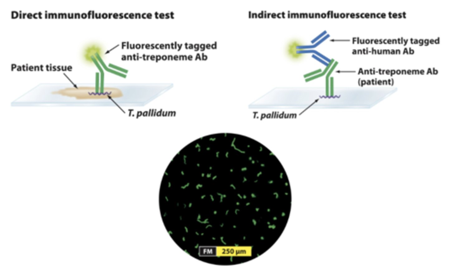 <p>A technique where antibodies bind specific antigens in cells and are linked to fluorescent markers.</p>