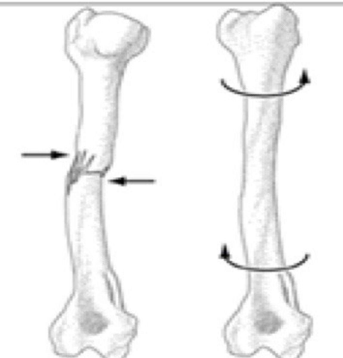 <p>act of twisting; stress due to twisting forces exerted on a body</p>