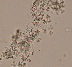 <p>What type of acid urine crystal is this?</p>