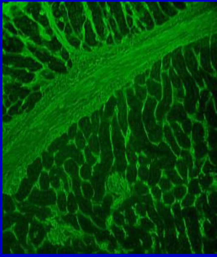 <p>Anti-reticulin</p>