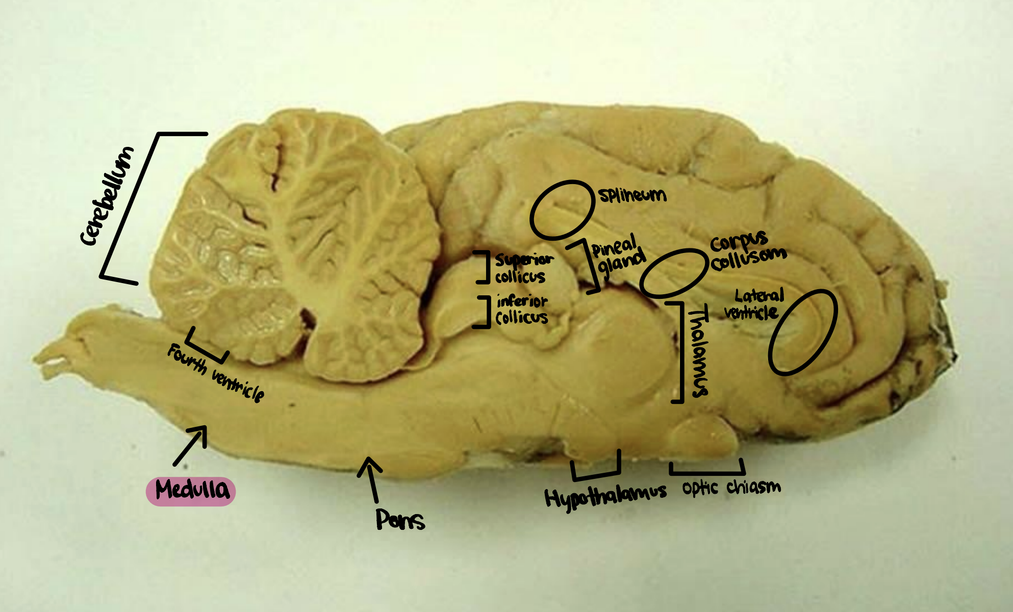 <p>Medulla</p>