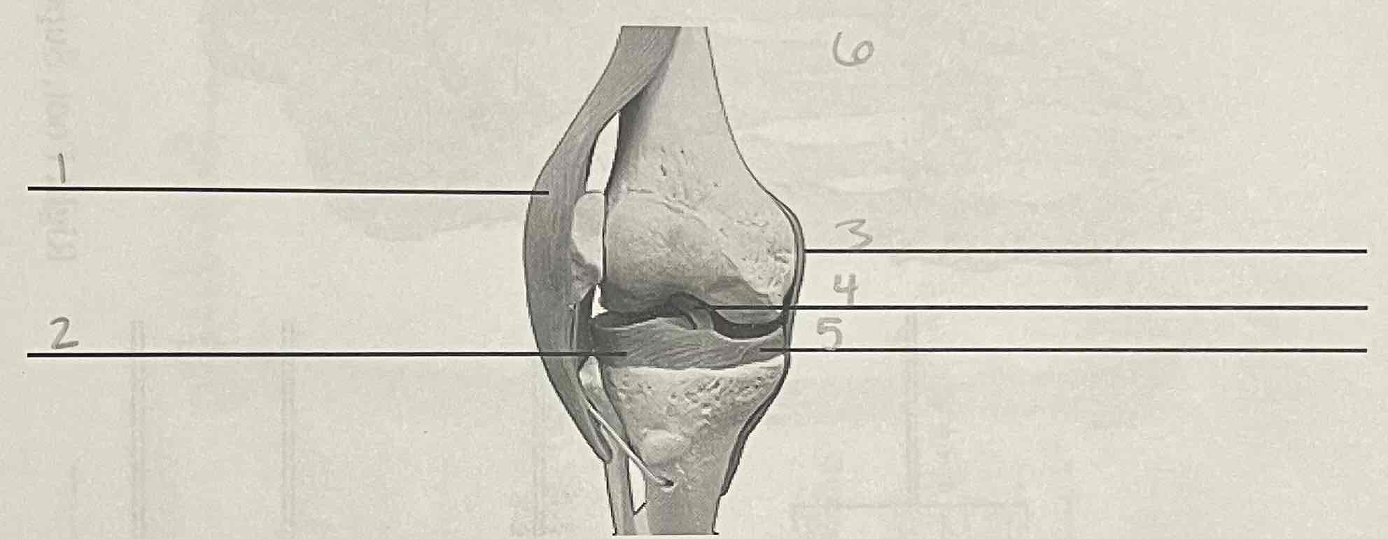 <p>6 (side, name, view of bone)</p>