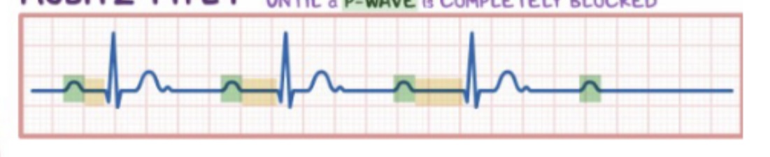 Progressive lengthening of PR till beat drops 