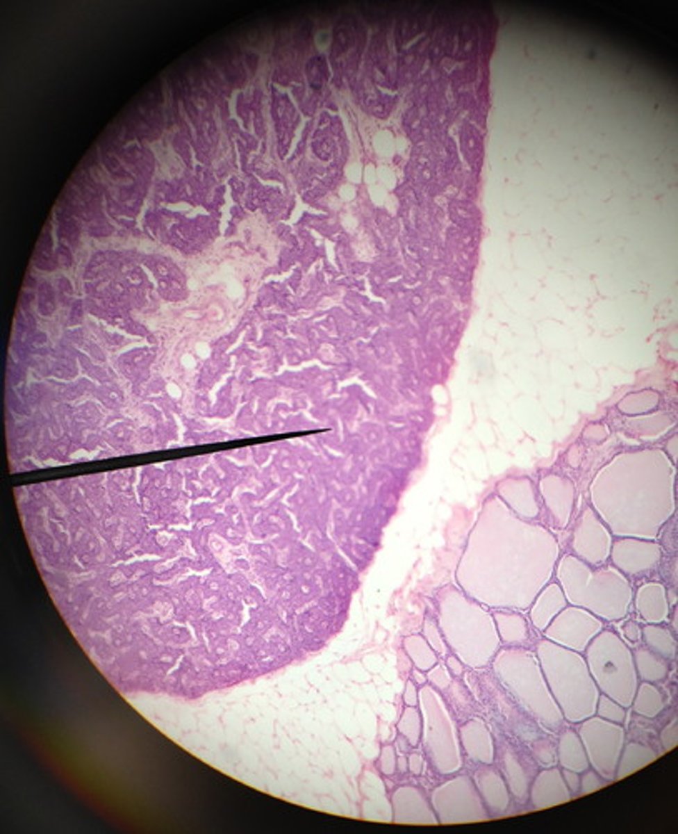 <p>Identify this organ and the hormone produced</p>