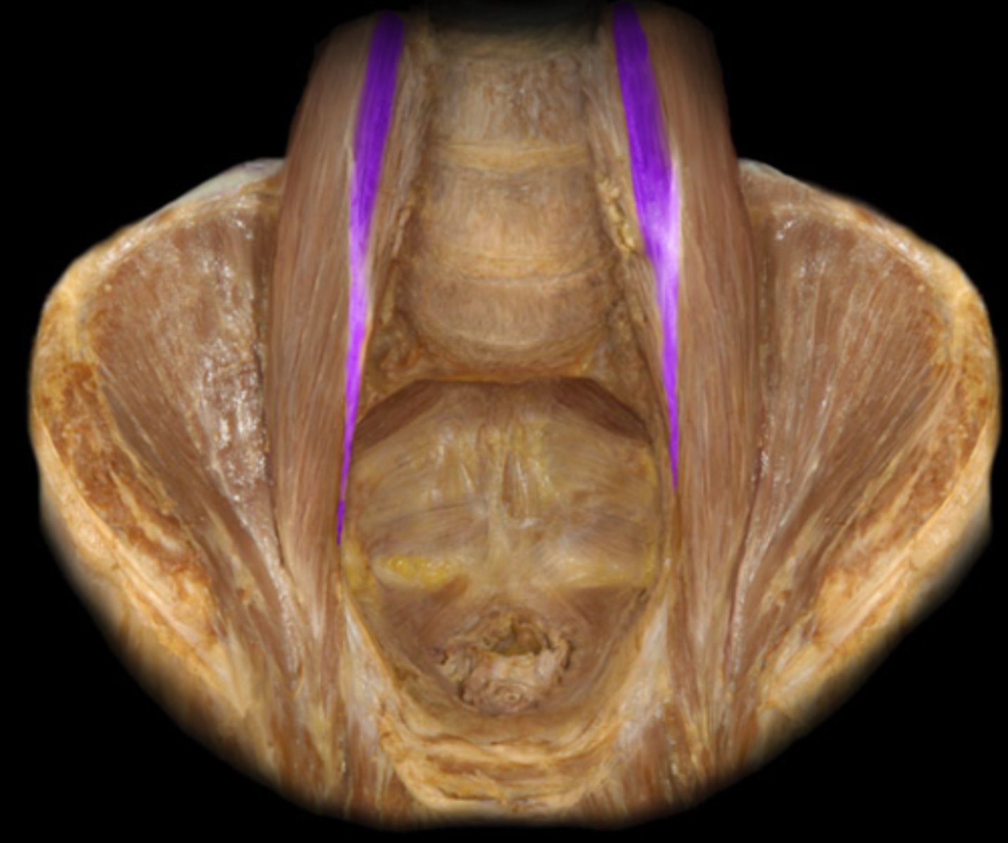 <p>tendon on top of major</p><p>(pelvis)</p>