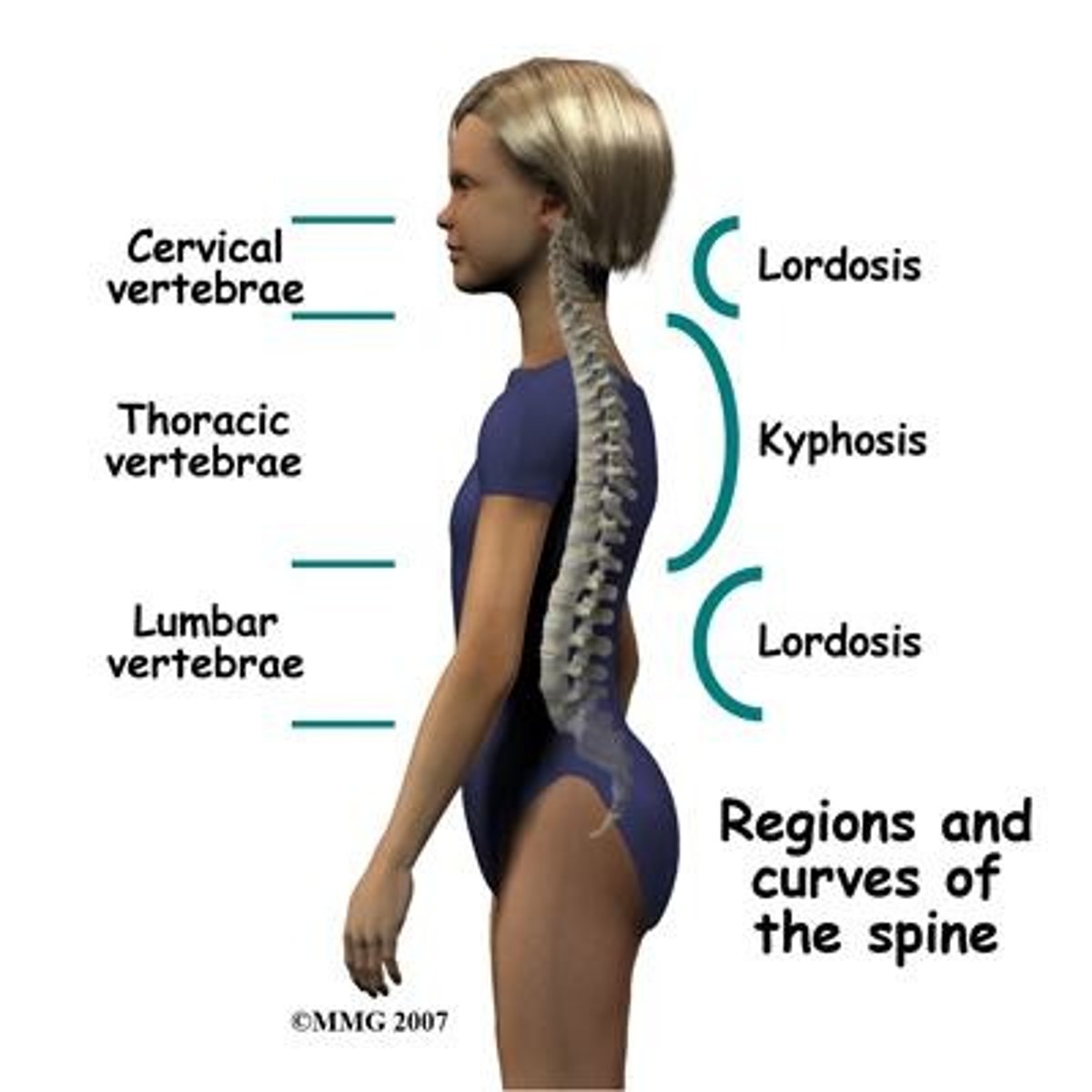 <p>Exaggerated posterior curvature of the thoracic spine, often referred to as 'humpback'.</p>