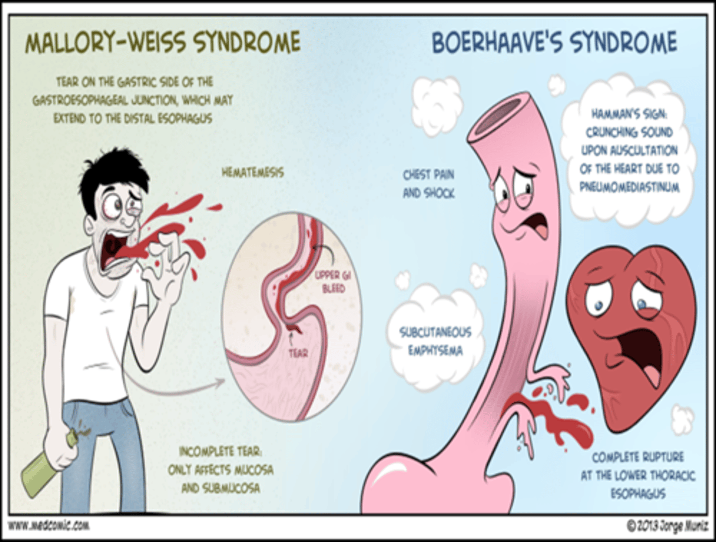 <p>Boerhaave's syndrome</p>