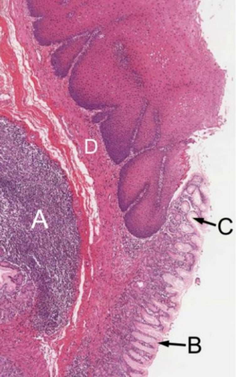 <p>gastroesophageal junction</p>
