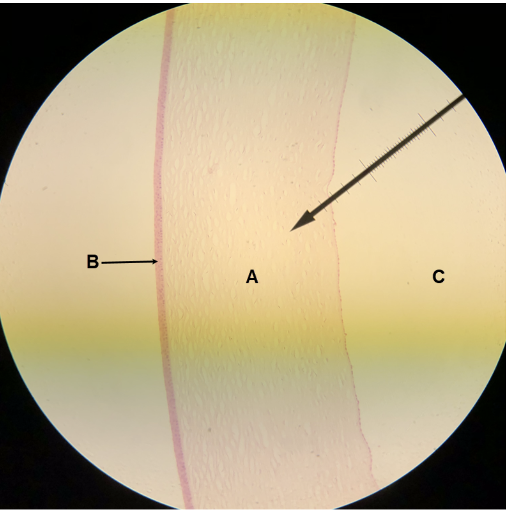 <p><span><span>In the image above, identify structure/part of the eye wall A, structure/tissue B, and space C.</span></span></p>