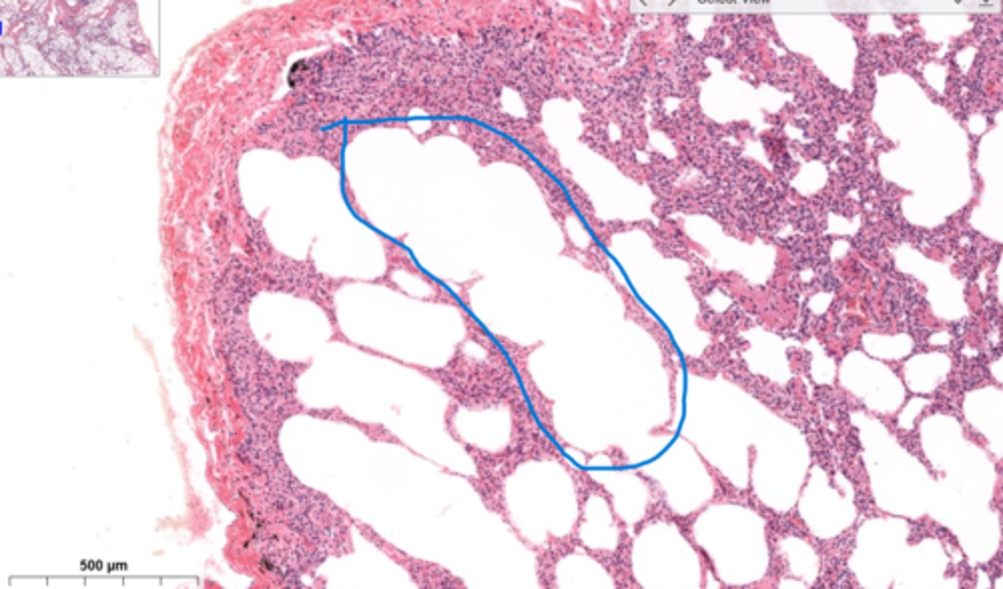 <p>What is the area encircled in blue?</p>