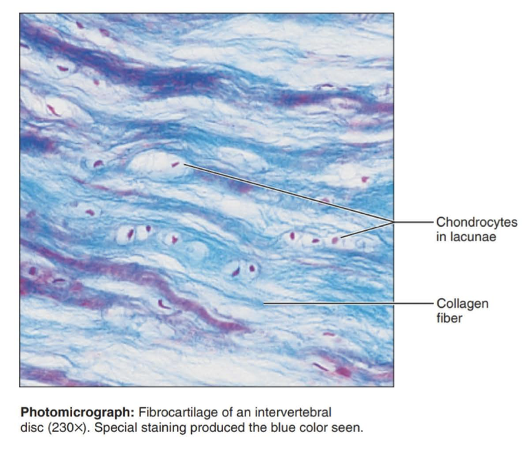 <p>cartilage that contains fibrous bundles of collagen, such as that of the intervertebral disks in the spinal cord.</p>