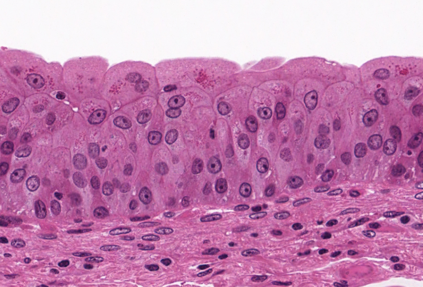 or transitional epithelium