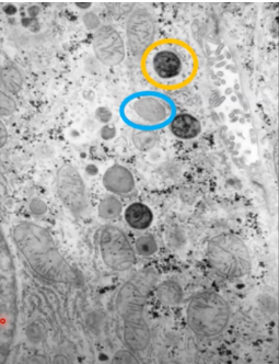 <p>What type of lysosome is in the blue circle?</p>