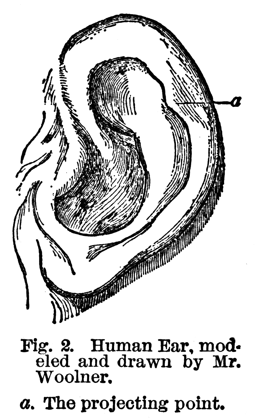 <p>Superior-posterior bulge on the helix. </p>
