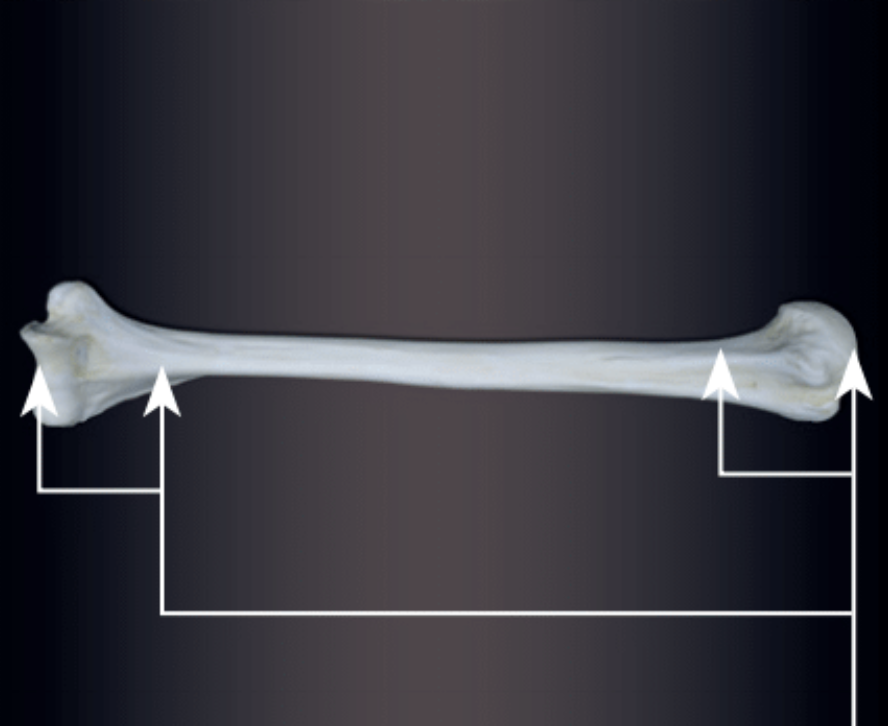 <p>end of a long bone that is originally separated by hyaline and later united</p>