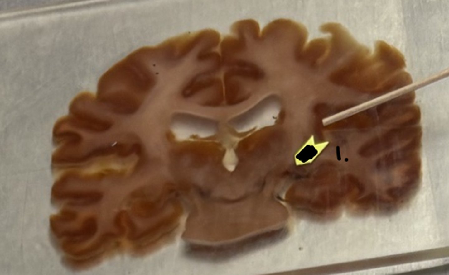 <p>what structure is labeled as #1 ?</p>