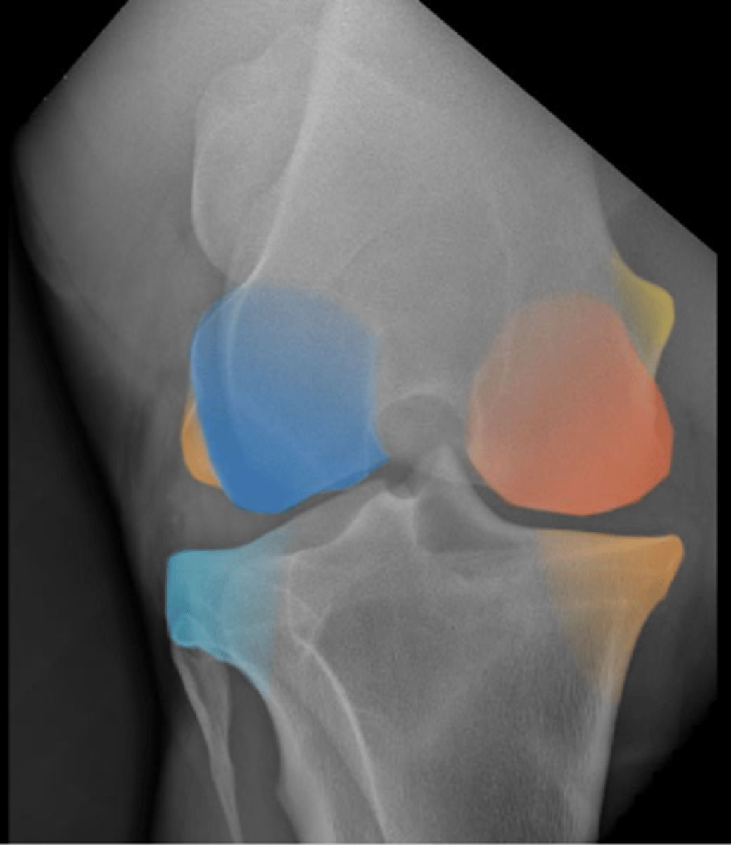 <p>Bony Side Projections</p>