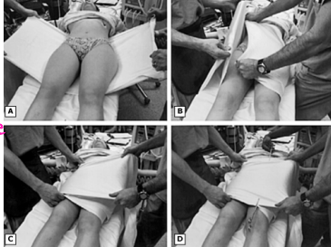 <p><strong>Pelvic Fractures: Treatment and Complications</strong></p><p>-Treatment</p><ul><li><p>Pelvic ___________ to reduce the amount of blood loss and stabilize bone fragments </p></li><li><p>Definitive treatment depends on fracture type </p></li></ul><p>-Complications</p><ul><li><p>_______________ → veins or superior _______/internal pudendal/internal ______ arteries </p></li><li><p>Neurologic injury → do thorough lower body neuro exam </p></li><li><p>Urogenital injury → _______, urethra, vagina, and rectum</p></li></ul><p></p>