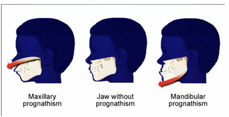 <p>maxillary and mandibular </p>
