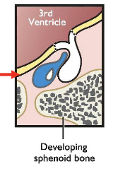 <p>what is happening here</p>