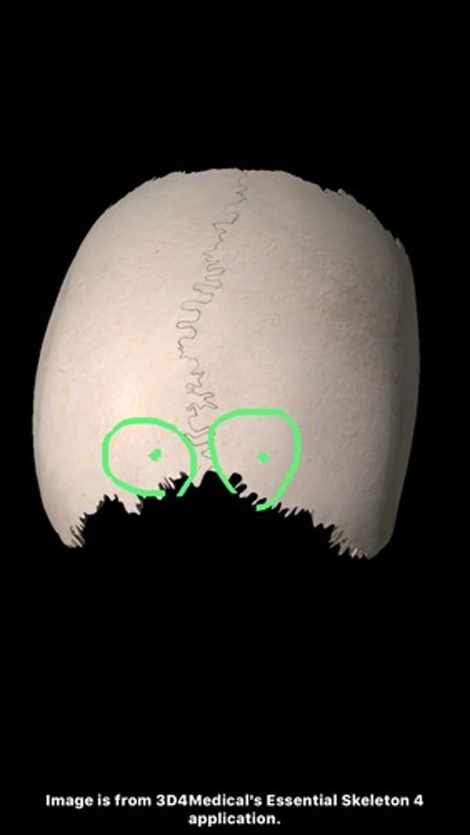<p>located close to the sagittal suture near lambda</p>