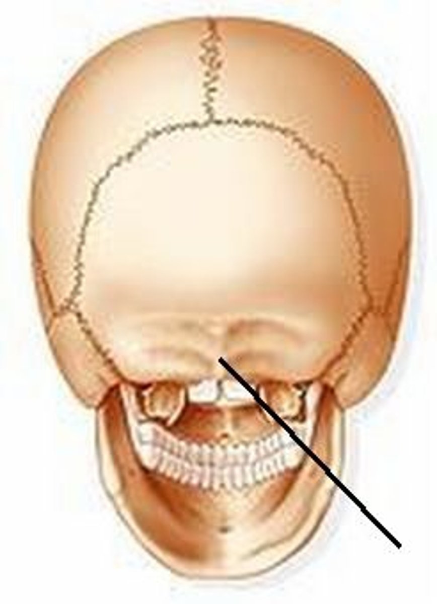 <p>What bone is this?</p>