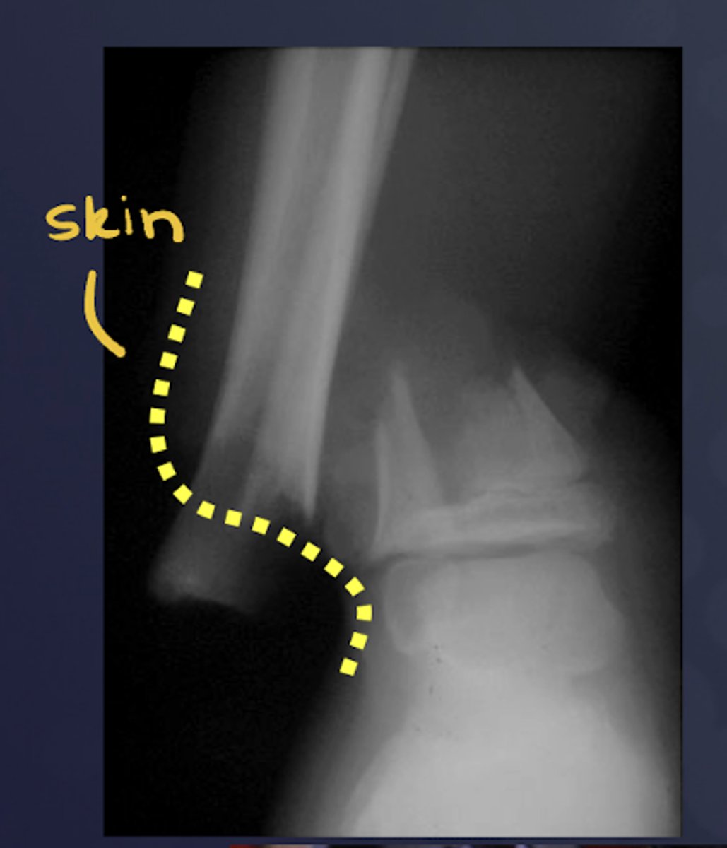 <p>Open vs. closed</p>