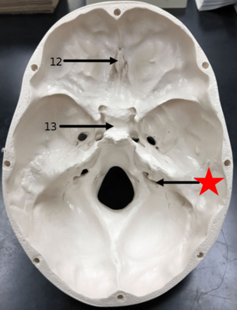 <p>Name the starred region in the image.</p>