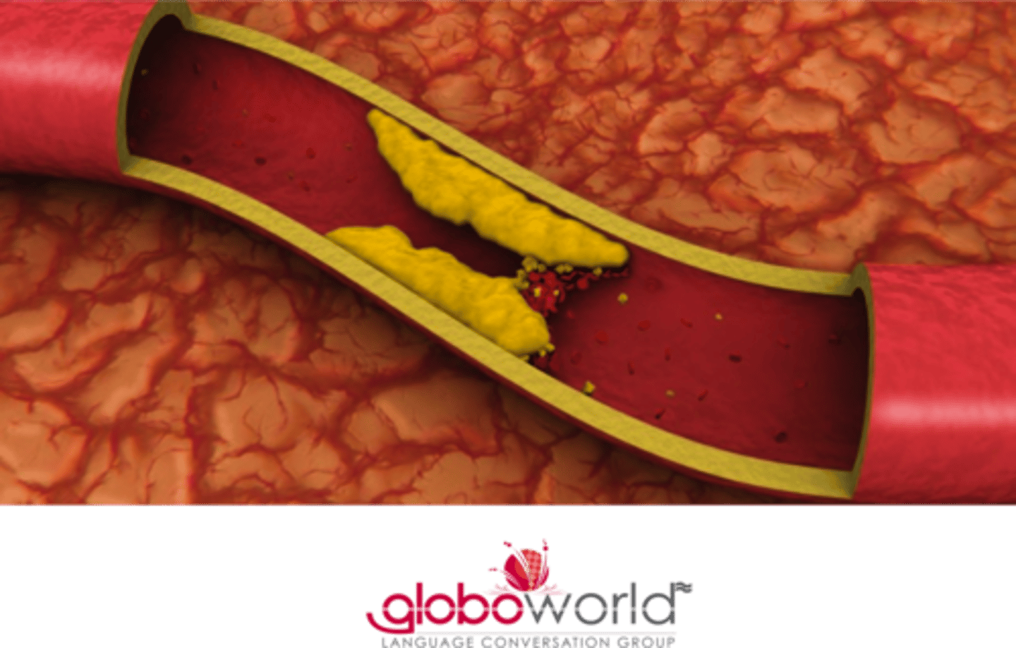 <p>el colesterol</p>