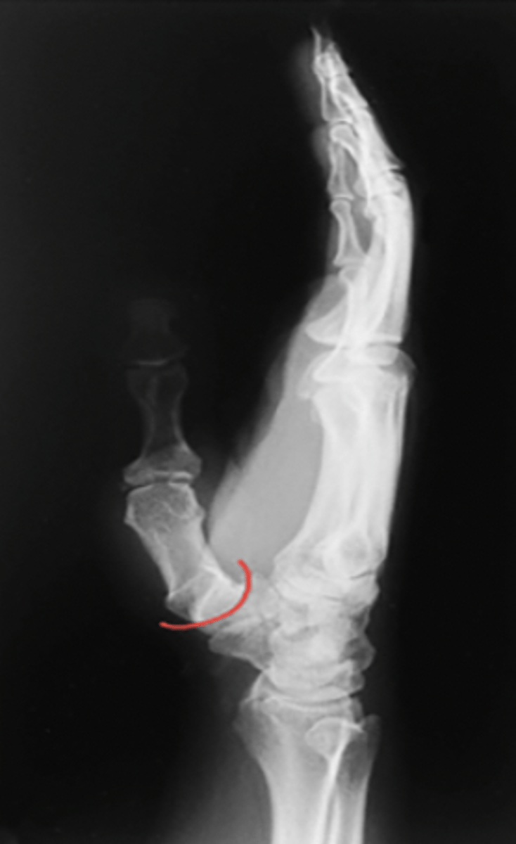 <p>What structure is highlighted?</p>