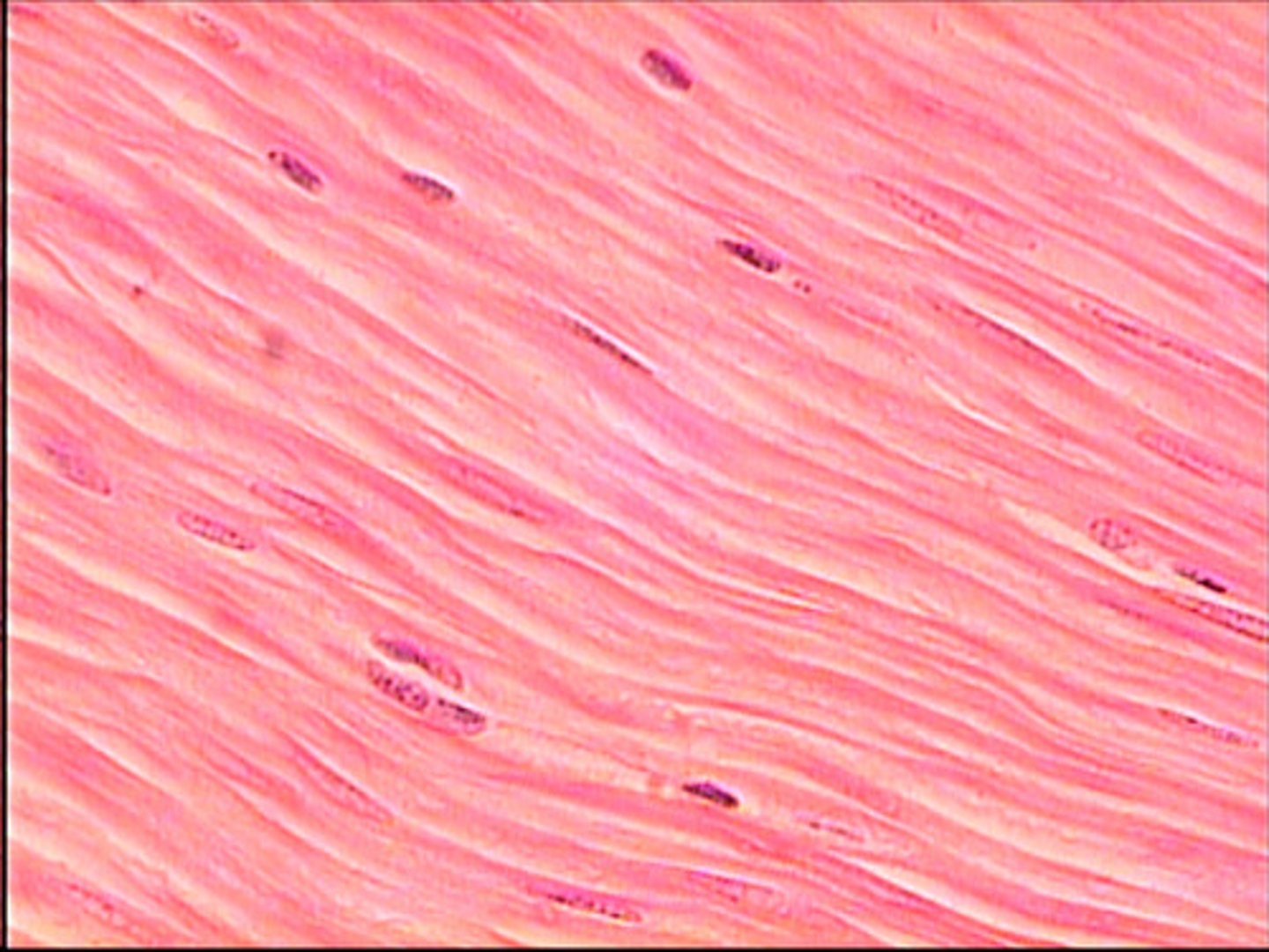 <p>- cells are spindle shaped with central nuclei</p><p>- no striations</p><p>- cells are arranged closely to form sheet</p><p>- moderate regeneration</p>