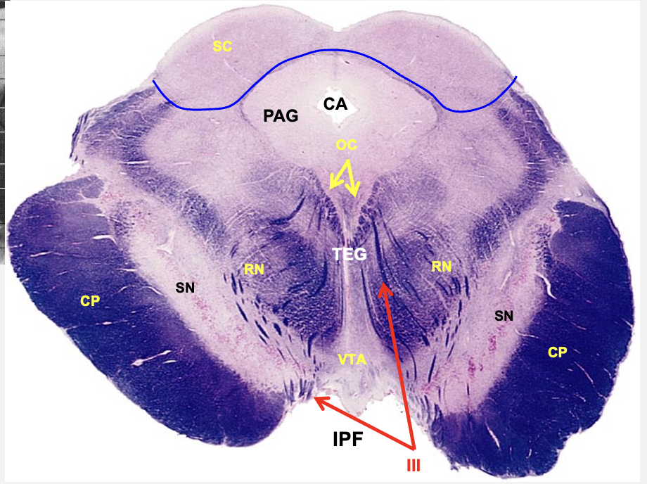<p>rostral midbrain cross section structures </p>