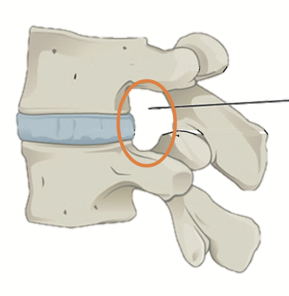 <p>In between each pair of vertebrae, where a pair of nerves (spinal nerves) exit and enter the spinal cord to innervate distinct sections of the body.</p>