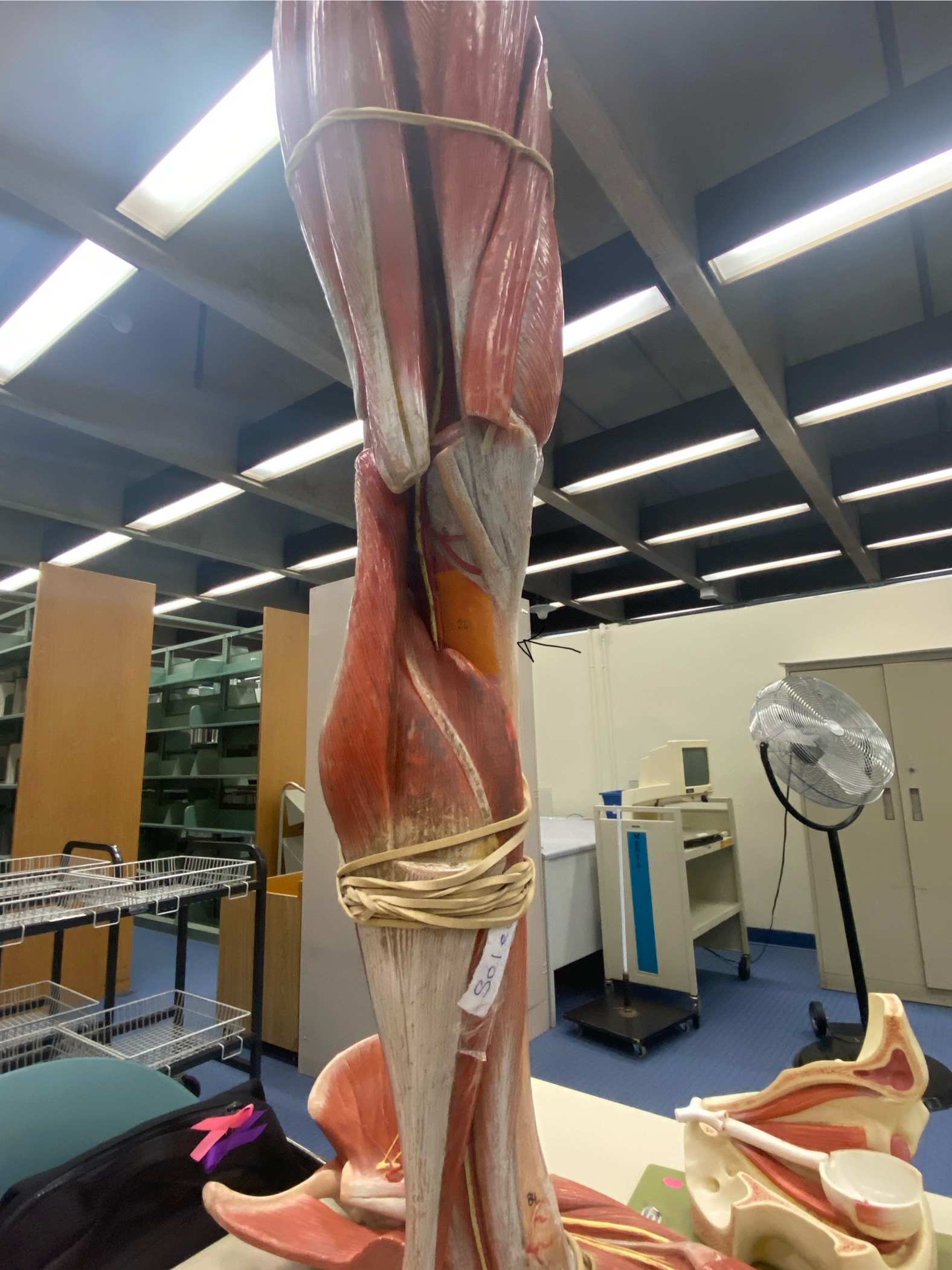 <p>What muscle is this?*****</p><p>(come back) </p>