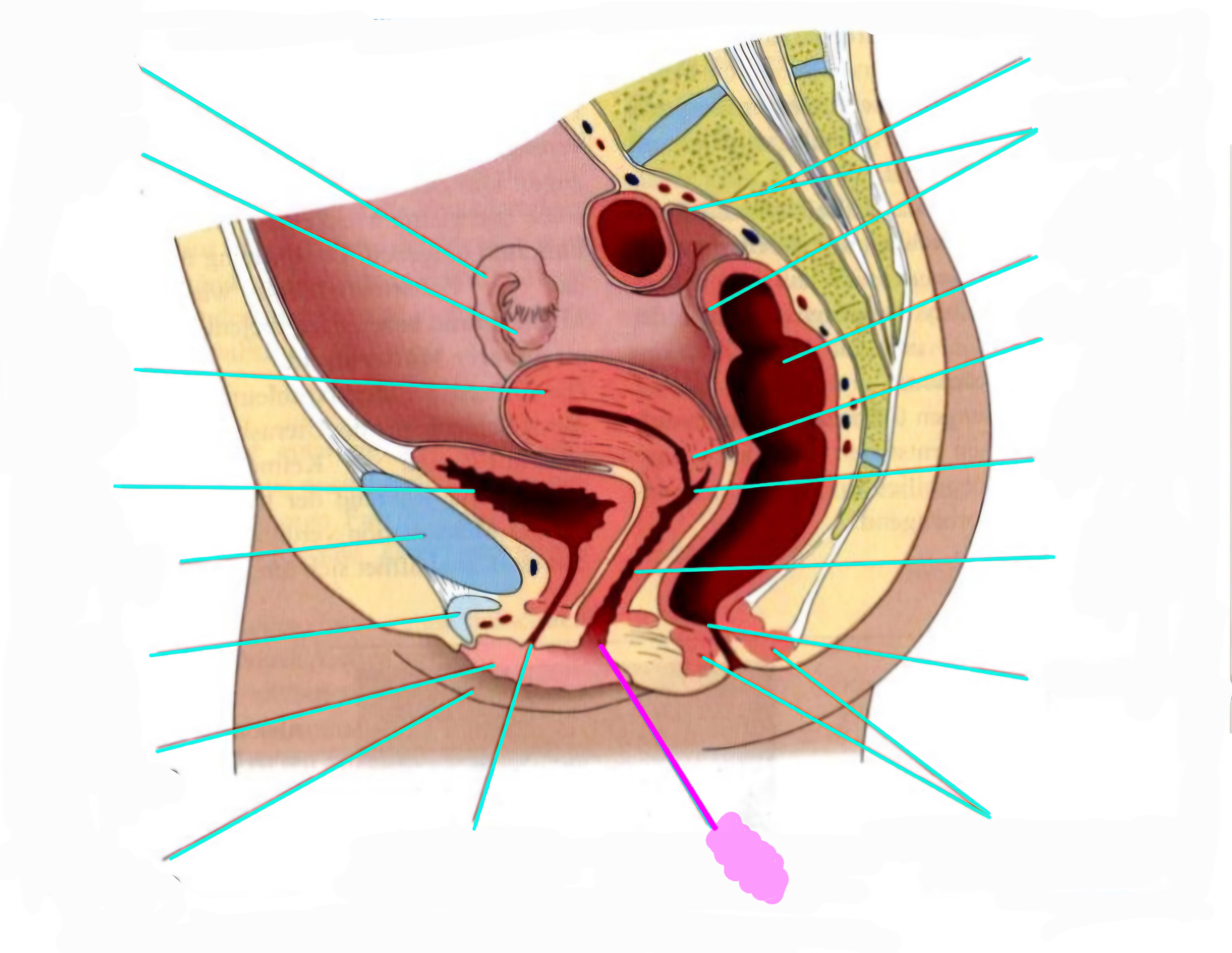 term image