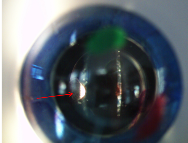 <p>what surface is red arrow pointing to on lesion if illumination on the left&nbsp;</p>